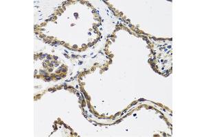 Immunohistochemistry of paraffin-embedded human prostate using CALCB antibody (ABIN5974487) at dilution of 1/100 (40x lens).