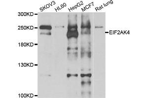 Western blot analysis of extracts of various cell lines, using EIF2AK4 antibody. (GCN2 antibody)