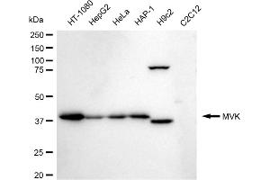 Western blotting analysis using MVK antibody (ABIN7799401).