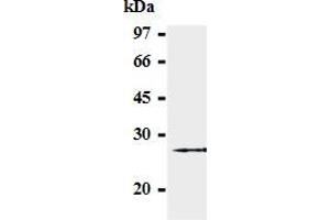 Western blot analysis of GST-SOCS-3 (2-44 a. (SOCS3 antibody  (AA 2-44))