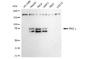 Western blotting analysis using PKC gamma antibody (ABIN7799999).
