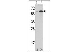Image no. 2 for anti-Estrogen-Related Receptor gamma (ESRRG) (AA 198-227) antibody (ABIN360233)
