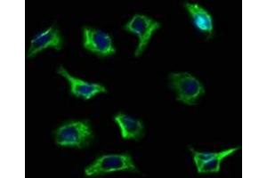 Immunofluorescence staining of A549 cells with ABIN7168513 at 1:100, counter-stained with DAPI. (RYR3 antibody  (AA 987-1147))