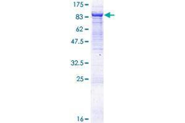 VPS33B Protein (AA 1-617) (GST tag)