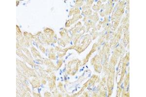 Immunohistochemistry of paraffin-embedded Rat heart using ALOX12 Polyclonal Antibody at dilution of 1:100 (40x lens). (ALOX12 antibody)