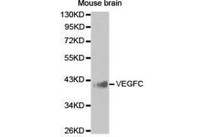 Western Blotting (WB) image for anti-Vascular Endothelial Growth Factor C (VEGFC) antibody (ABIN1875325) (VEGFC antibody)