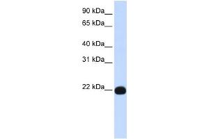 WB Suggested Anti-PIGA Antibody Titration:  0. (PIGA antibody  (Middle Region))