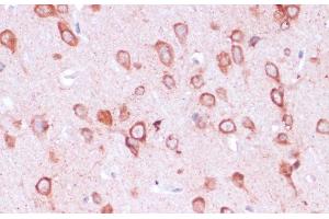 Immunohistochemistry of paraffin-embedded Rat brain using RPL21 Polyclonal Antibody at dilution of 1:100 (40x lens).
