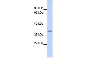 WB Suggested Anti-TEX264 Antibody Titration:  0. (TEX264 antibody  (Middle Region))
