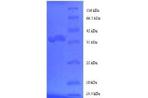 SDS-PAGE (SDS) image for FK506 Binding Protein 1A, 12kDa (FKBP1A) (AA 2-103), (partial) protein (GST tag) (ABIN7479235)