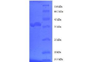 FK506 Binding Protein 1A, 12kDa (FKBP1A) (AA 2-103), (partial) protein (GST tag) (FKBP1A Protein (AA 2-103, partial) (GST tag))