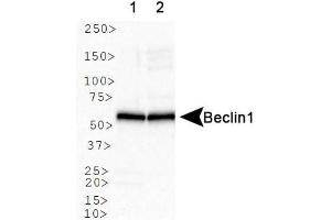 Image no. 6 for anti-Beclin 1, Autophagy Related (BECN1) antibody (ABIN363435) (Beclin 1 antibody)