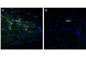 Expression of Oxytocyn Receptor in rat midbrain. (Oxytocin Receptor antibody  (C-Term, Intracellular))