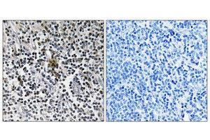 Immunohistochemistry (IHC) image for anti-Ribosomal Protein S3 (RPS3) (C-Term) antibody (ABIN1850588)