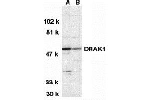 Western Blotting (WB) image for anti-serine/threonine Kinase 17a (STK17A) (N-Term) antibody (ABIN1031360) (STK17A antibody  (N-Term))