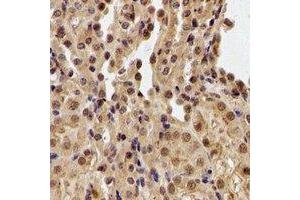 Immunohistochemical analysis of PHF21B staining in human kidney formalin fixed paraffin embedded tissue section. (PHF21B antibody)