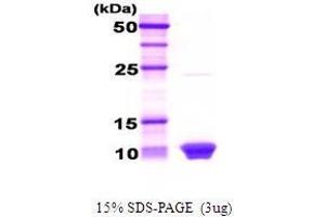 Figure annotation denotes ug of protein loaded and % gel used. (HSBP1 Protein)