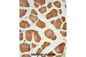 Formalin-fixed and paraffin-embedded human skeletal muscle reacted with ANGPTL4 Antibody (Center), which was peroxidase-conjugated to the secondary antibody, followed by DAB staining. (ANGPTL4 antibody  (Middle Region))
