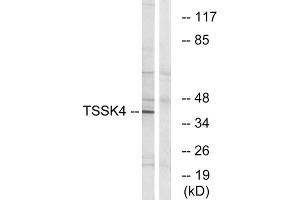 Western blot analysis of extracts from HT-29 cells, using TSSK4 antibody. (TSSK4 antibody  (Internal Region))