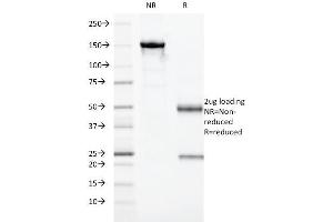 SDS-PAGE Analysis Purified HLA-DRA Monoclonal Antibody (19-26.