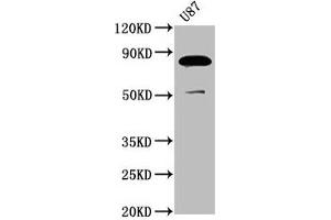 Western Blot Positive WB detected in: U87 whole cell lysate All lanes: FRMD7 antibody at 3. (FRMD7 antibody  (AA 464-617))