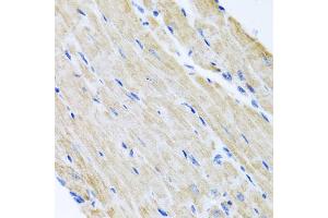 Immunohistochemistry of paraffin-embedded mouse heart using ABCB8 antibody (ABIN5974712) at dilution of 1/100 (40x lens). (ABCB8 antibody)