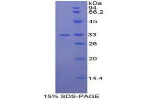SDS-PAGE (SDS) image for Jagged 2 (JAG2) (AA 714-981) protein (His-GST) (ABIN2125514)