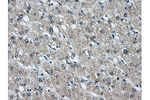 Immunohistochemical staining of paraffin-embedded liver tissue using anti-HDAC10mouse monoclonal antibody. (HDAC10 antibody)