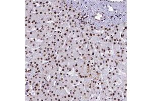 Immunohistochemical staining of human liver with SRRM2 polyclonal antibody  shows strong nuclear positivity in hepatocytes. (SRRM2 antibody)