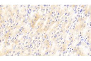 Detection of MIg in Mouse Kidney Tissue using Polyclonal Antibody to Monokine Induced By Interferon Gamma (MIg) (CXCL9 antibody  (AA 22-126))