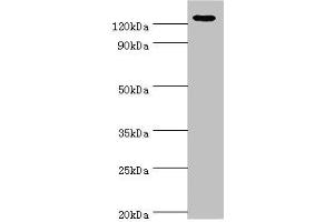 Western blot All lanes: NLRP2 antibody at 12 μg/mL + A431 whole cell lysate Secondary Goat polyclonal to rabbit IgG at 1/10000 dilution Predicted band size: 121, 119, 97, 118 kDa Observed band size: 121 kDa (NLRP2 antibody  (AA 1-220))