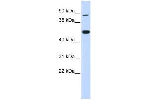 WB Suggested Anti-TRMT1 Antibody Titration:  0. (TRMT1 antibody  (N-Term))
