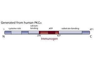 Image no. 3 for anti-Protein Kinase C, alpha (PKCa) (AA 270-427) antibody (ABIN967751) (PKC alpha antibody  (AA 270-427))