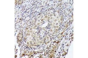 Immunohistochemistry of paraffin-embedded rat ovary using PSMD14 Rabbit mAb (ABIN7269588) at dilution of 1:100 (40x lens). (PSMD14 antibody)