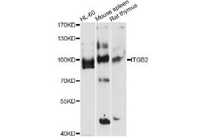 Western blot analysis of extracts of various cell lines, using ITGB2 antibody (ABIN5971200) at 1/1000 dilution. (Integrin beta 2 antibody)