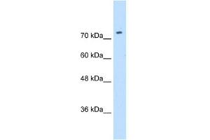 WB Suggested Anti-SLC7A1 Antibody Titration:  0. (SLC7A1 antibody  (N-Term))