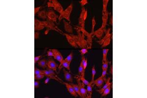 Immunofluorescence analysis of PC-12 cells using Proprotein Convertase 9(PCSK9) Rabbit pAb (ABIN6133851, ABIN6145328, ABIN6145330 and ABIN6223837) at dilution of 1:250 (40x lens). (PCSK9 antibody  (C-Term))