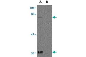 Western blot analysis of NAA35 in rat heart tissue lysate with NAA35 polyclonal antibody  at 1 ug/mL in the (A) absence and (B) presence of blocking peptide. (MAK10/NAA35 antibody  (N-Term))