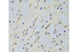 Immunohistochemistry of paraffin-embedded Mouse brain using DARS Polyclonal Antibody at dilution of 1:100 (40x lens). (DARS antibody)