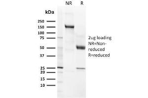 SDS-PAGE Analysis Purified CD21 / CR2 Recombinant Rabbit Monoclonal Antibody (CR2/3124R). (Recombinant CD21 antibody  (AA 142-240))