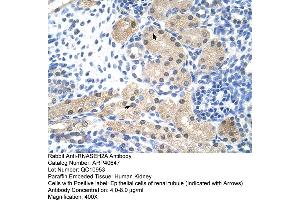 Rabbit Anti-RNASEH2A Antibody  Paraffin Embedded Tissue: Human Kidney Cellular Data: Epithelial cells of renal tubule Antibody Concentration: 4. (RNASEH2A antibody  (Middle Region))