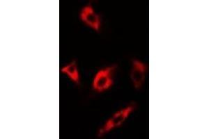 Immunofluorescent analysis of MsrA staining in U2OS cells. (MSRA antibody)