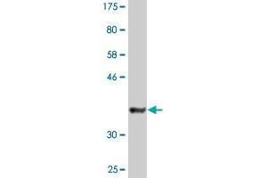 Western Blot detection against Immunogen (36. (DTNBP1 antibody  (AA 1-100))