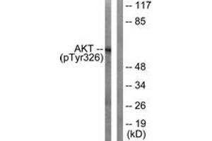 Western blot analysis of extracts from mouse liver, using Akt (Phospho-Tyr326) Antibody.