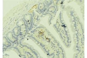 ABIN6279274 at 1/100 staining Mouse colon tissue by IHC-P. (Centriolin antibody)