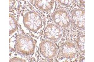 Immunohistochemistry of TEM1 in human colon tissue with this product at 2. (CD248 antibody  (N-Term))