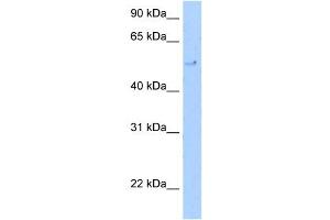 WB Suggested Anti-TERF2 Antibody Titration: 5.