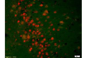 Immunofluorescence (IF) image for anti-Receptor Tyrosine-Protein Kinase ErbB-3 (ERBB3) (pTyr1289) antibody (ABIN747113)