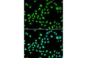 Immunofluorescence analysis of A549 cells using GTF2F2 antibody. (GTF2F2 antibody  (AA 1-249))