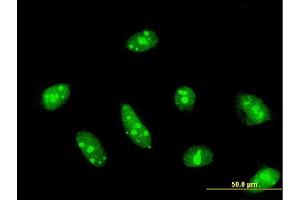 Immunofluorescence of monoclonal antibody to CDC14A on HeLa cell. (CDC14A antibody  (AA 431-530))